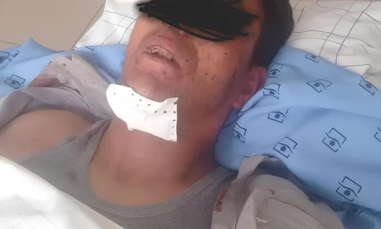 العيون.. عسكري يبتر العضو التناسلي لرجل ضبطه مع زوجته