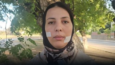 سنتان ونصف سجناً للمتهم بتشويه وجه خديجة